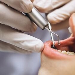 6-Amazing-Facts-You-Should-Know-About-Tooth-Implant-Process-604x270