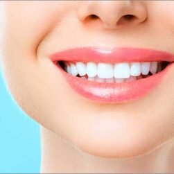 smile-designing